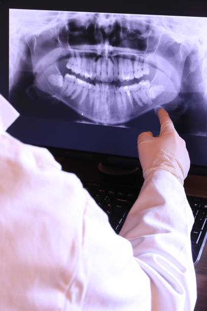 Best Emergency Tooth Extraction in Reeds Spring, MO